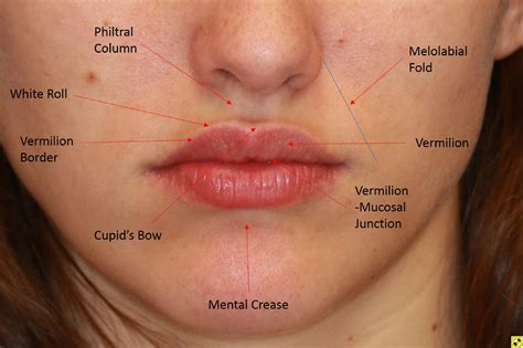 Lip reconstruction using the Sabattini-Abbé cross-lip flap - Operative Techniques in ...