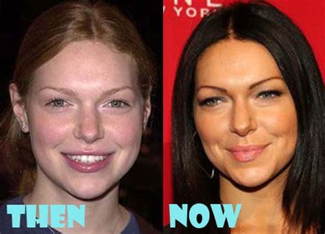 Laura Prepon Plastic Surgery Before and After Photos - Lovely Surgery