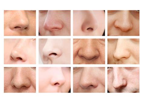 Different Kinds of Nose Jobs: Which Is Right for You?