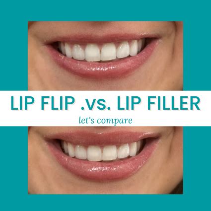 What's the difference between Lip Flips and Lip Filler | MOBO Medical Spa