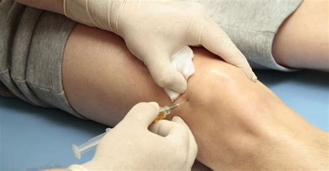 Injections for Knee Pain: Understand Your Options: ISP Health PLLC ...