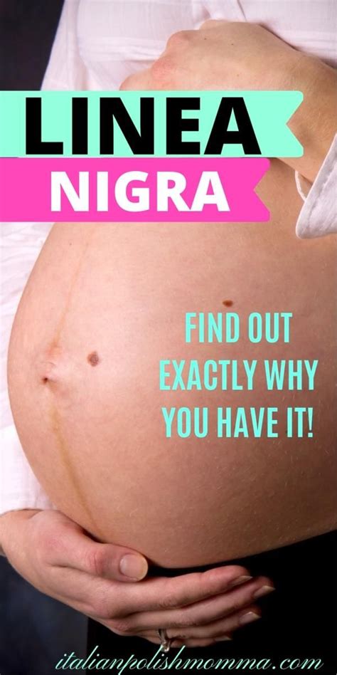 What is linea nigra your pregnancy belly line explained – Artofit
