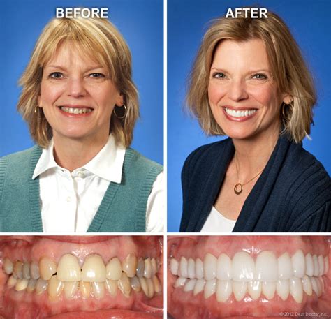 Cosmetic Dentistry | Moffett Dental Center | Harrisburg PA