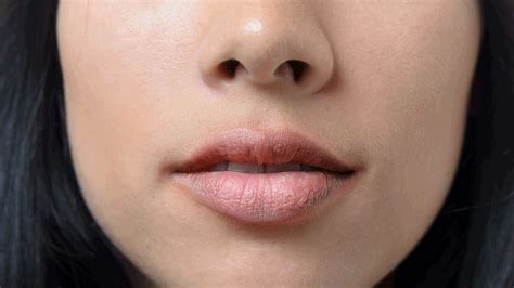 Red Rash On Inside Of Lips Lipstutorial Org - vrogue.co