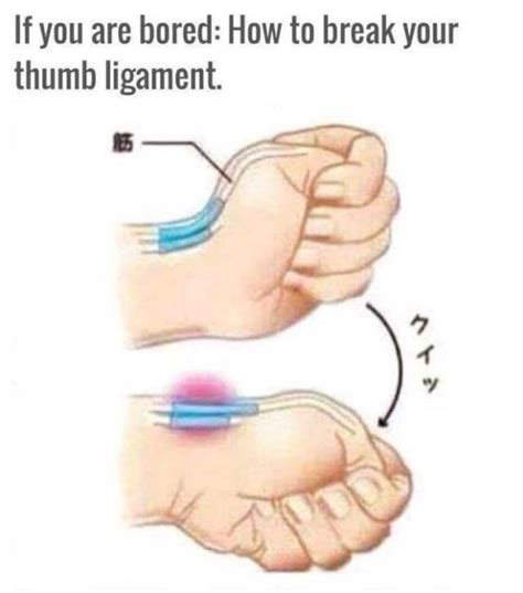 How To Dislocate Your Thumb | Others