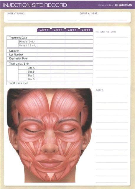 Resultado de imagen de Botox Injection Sites Chart Botox Injection ...