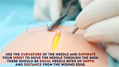 Simple Interrupted Suture - OSCE guide | Wound Suturing | Geeky Medics