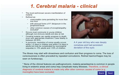 My malaria lecture