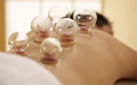 What Is Cupping? Does It Work? – Summars beauty and cupping