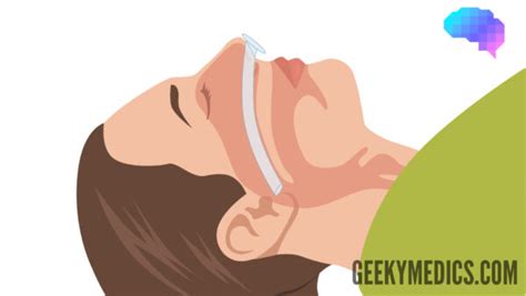 Nasopharyngeal Airway Insertion – OSCE Guide | LaptrinhX / News