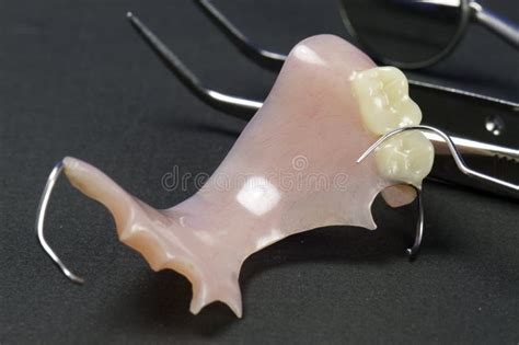 Partial Dental Bridge stock photo. Image of glass, dental - 10219560