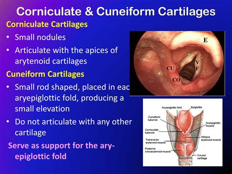 PPT - The Larynx PowerPoint Presentation - ID:417368