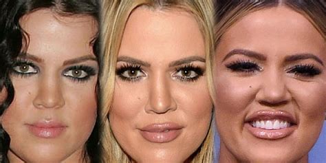 Khloé Kardashian Face Filler Transformation - BuzzPopDaily