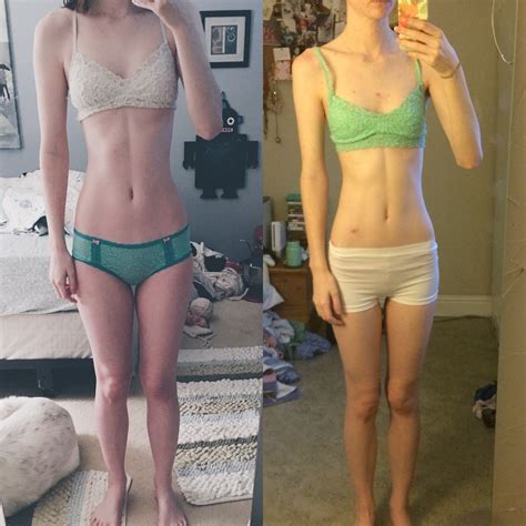 5'8", BMI 17-17.5? - General ED Discussions - Forums and Community