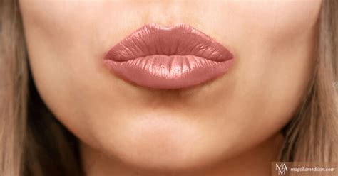 What Are The Different Types Of Lip Injections?