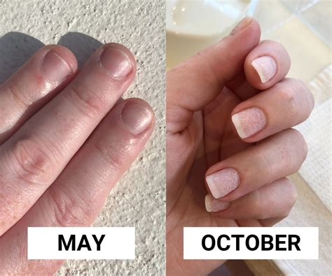 How to Stop Nail Biting: After 20 Years, This Is How I Finally Broke My ...