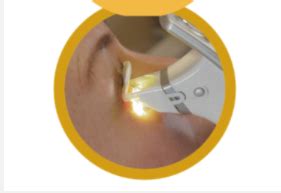 Alcon introduces new medical device for dry eye treatment