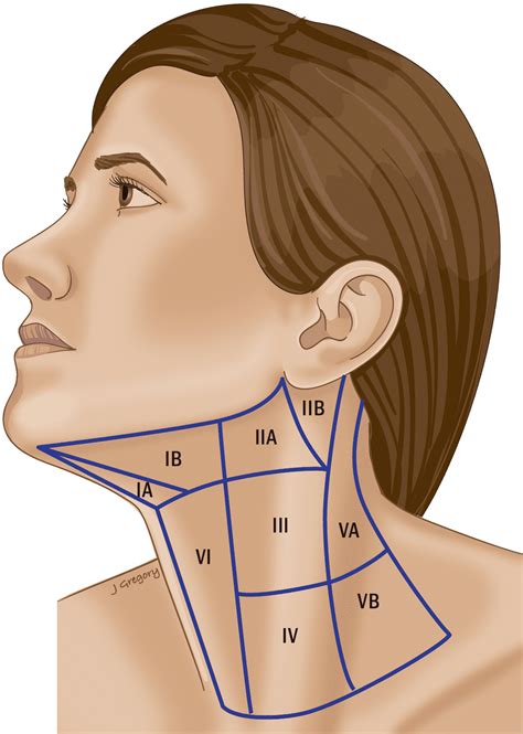 Fine Beautiful Info About How To Check Lymph Nodes In Neck - Airportprize