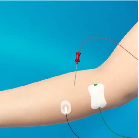 Electromyography (EMG) - Shore Spine & Pain