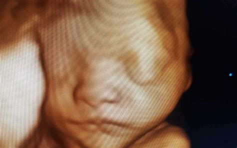 3dbabybump » 3D Baby Bump Ultrasound and Photography Palm Beach