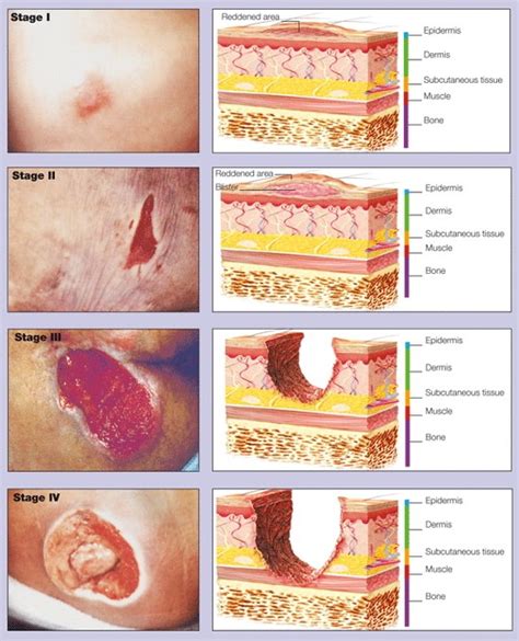 The Role Of Nutrition In Wound Healing - drarchanarathi WALLPAPER