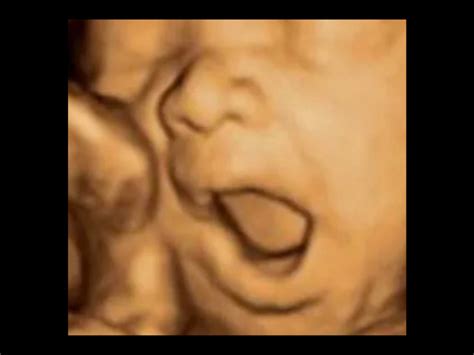 3D Baby Ultrasound | Love at First Scan | Crown Point, IN