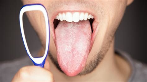 Tongue Color | 7 Scary Tongue Color Meanings - Mighty Goodness