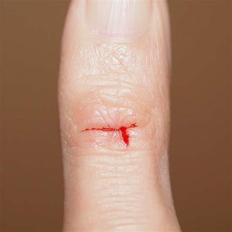 Paper Cut Finger Stock Photos, Pictures & Royalty-Free Images - iStock