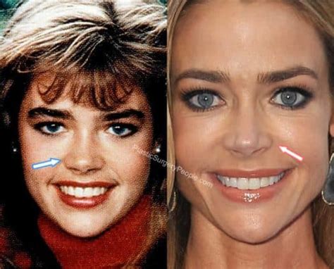 Denise Richards: BEFORE and AFTER 2019