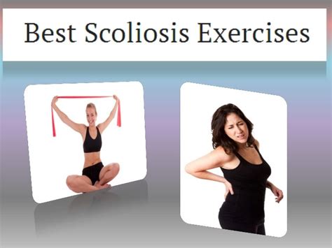 Best scoliosis exercises