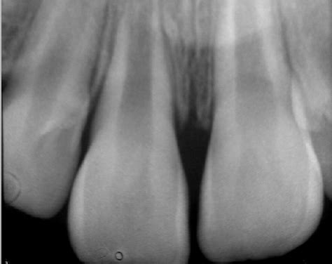 New Dental Traumatology Study Club Module - Spear Education