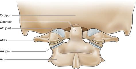 Atlanto-Occipital Joint Injections | Anesthesia Key