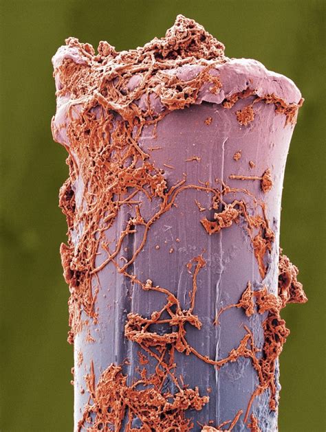 This Is What Tooth Plaque Looks Like Up Close | Microscopic photography ...