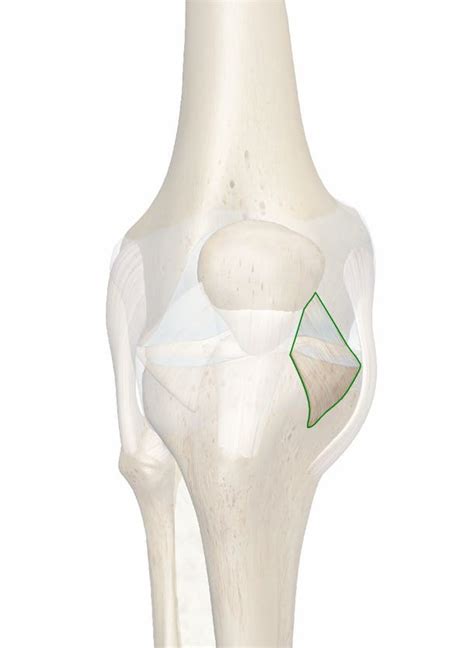 The Medial Patellar Retinaculum: 3D Anatomy Model