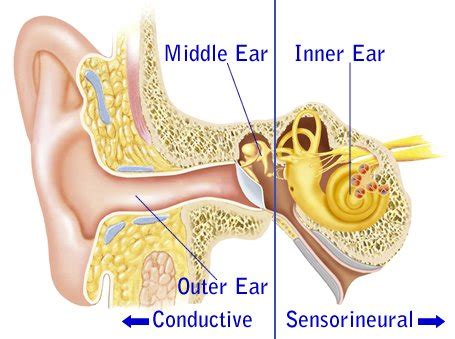 Conductive Hearing Loss - Learn About Symptoms + Treatments Available!