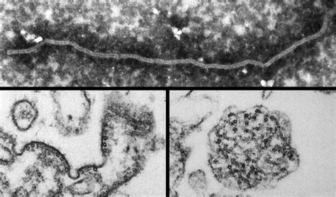 Free picture: ultrastructural, morphology, nipah virus