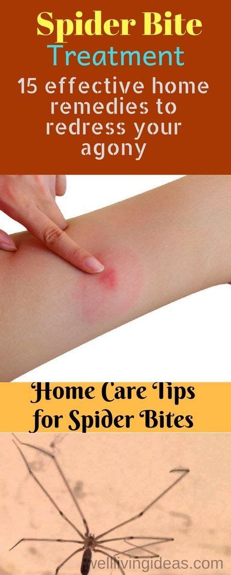15 Home Remedies to Treat a Spider Bite Quickly at Home | Spider bites, Spider bite treatment ...