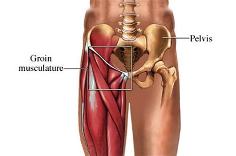 Groin Strain | Keystone Physiotherapy