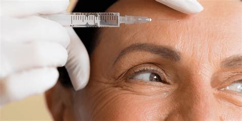 What Is "Baby Botox"—And Is It Worth It?