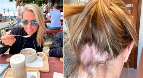 Luxury “hair protectors” from Olaplex “cause women to go bald and get blisters,” lawsuit claims ...