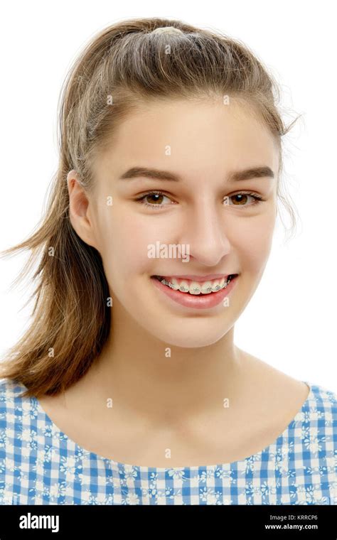 Portrait of Caucasian teenage girl with broad smile showing dental braces.Isolated on white ...