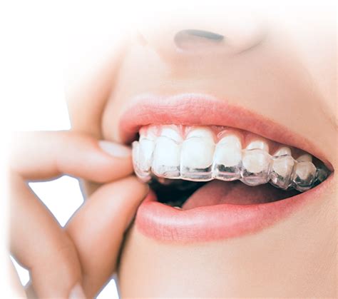 Which Invisalign Tray Hurts the Most? - Orland Park, IL