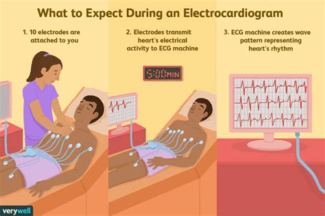 Ecg Procedure Steps Pdf