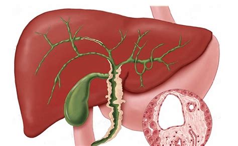 Primary Biliary Cholangitis Histology