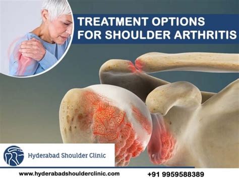 Treatment Options For Shoulder Arthritis - shoulder clinic Hyderabad