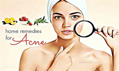 39 Natural Home Remedies for Acne on Face & Body