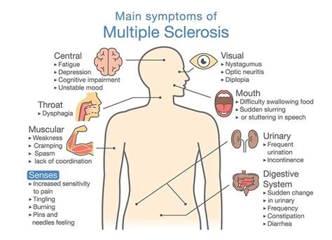 16 Warning Signs & Symptoms of Multiple Sclerosis | Optic neuritis, Multiple sclerosis, Signs ...