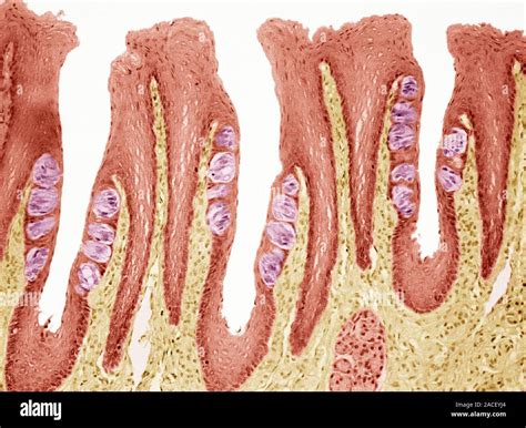 Las papilas gustativas. Luz de color Micrografía de una sección a través de la lengüeta ...