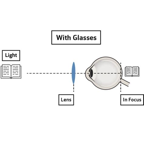 Presbyopia treatment options | Vision Express