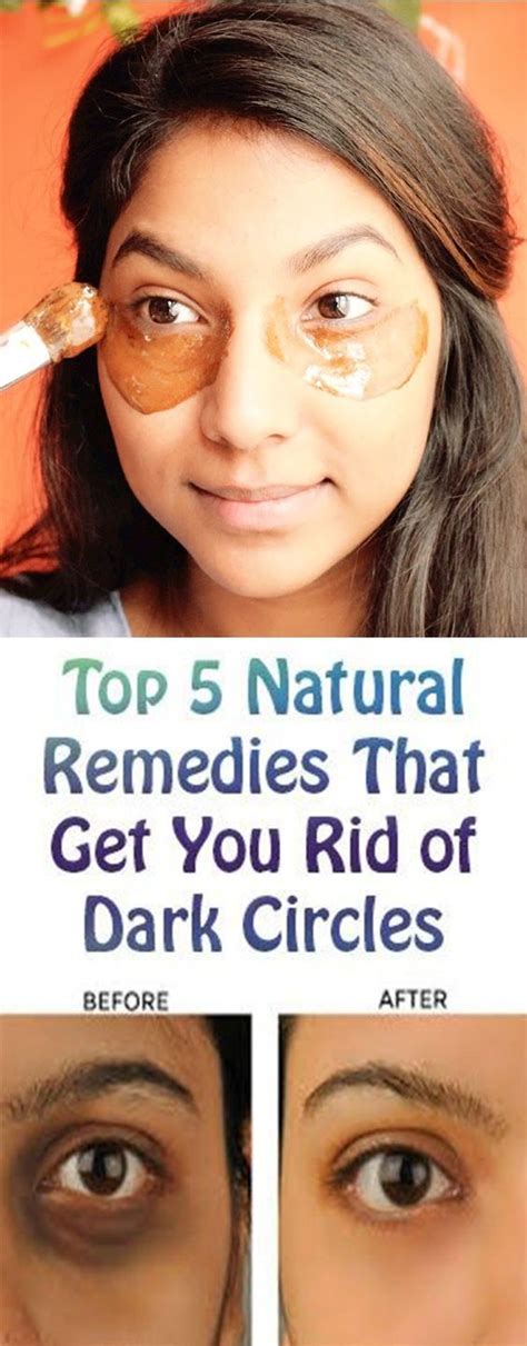 Home Remedies To Get Rid Of Dark Circles Under The Eyes